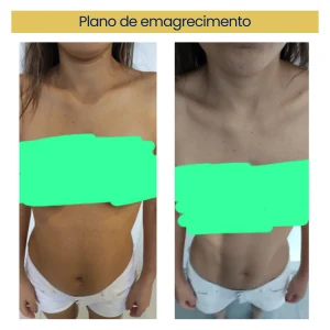 Paciente antes e depois do plano de emagrecimento: abdômen mais definido